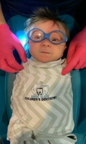 Easton -Frenectomy Patient Frenectomy Patient